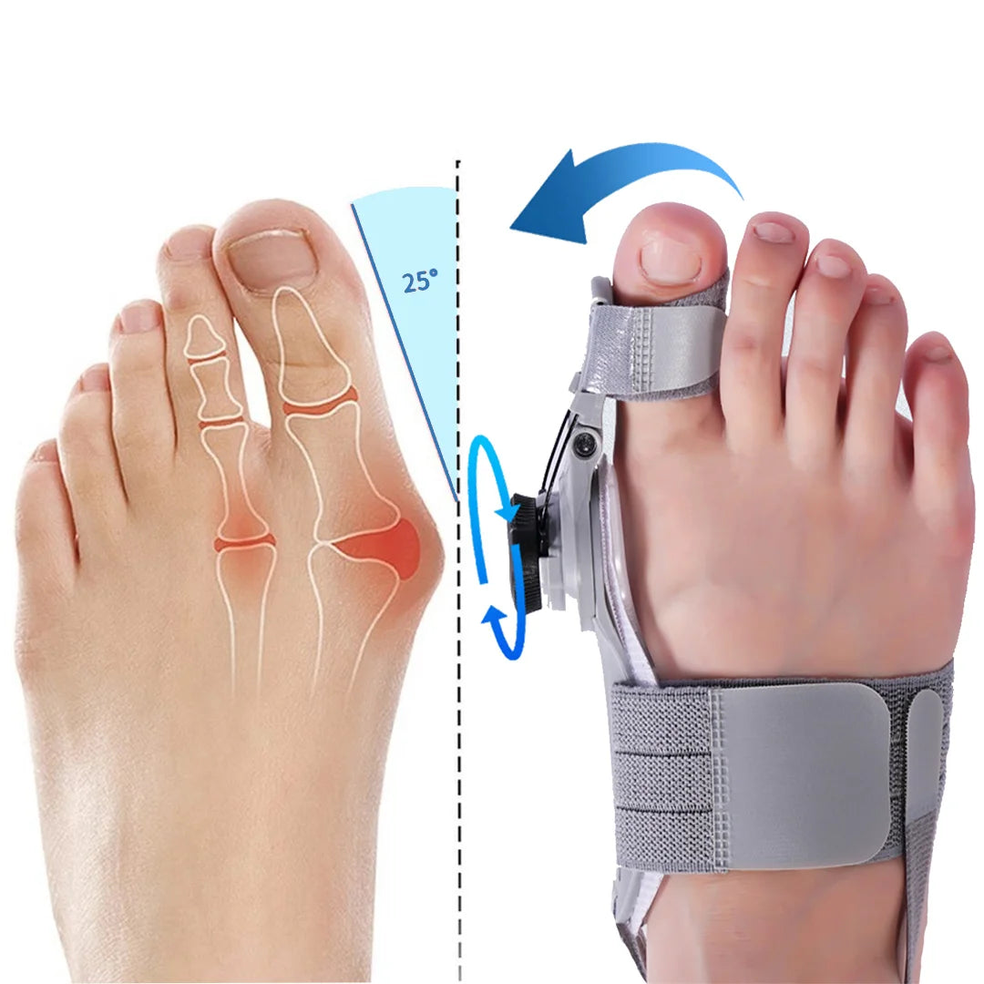 Bonex™ Bunion Fix