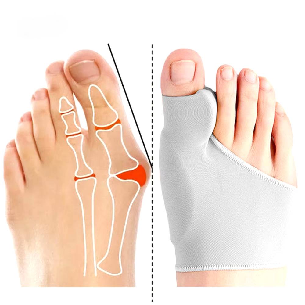 Compact Valgus Bone Corrector